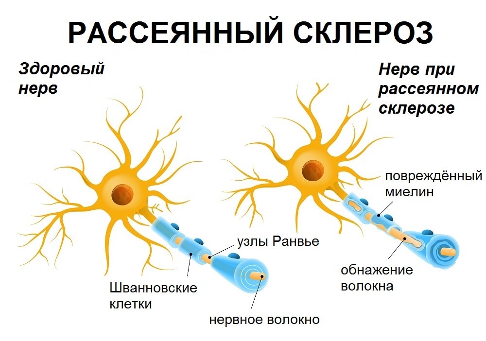 Фото с сайта santerramed.ru